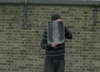 "Downtime" je video o tom, jak se po zranění vrátit zpět
